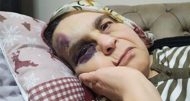 Şehir zorbası yaşlı çifti öldüresiyle dövdü